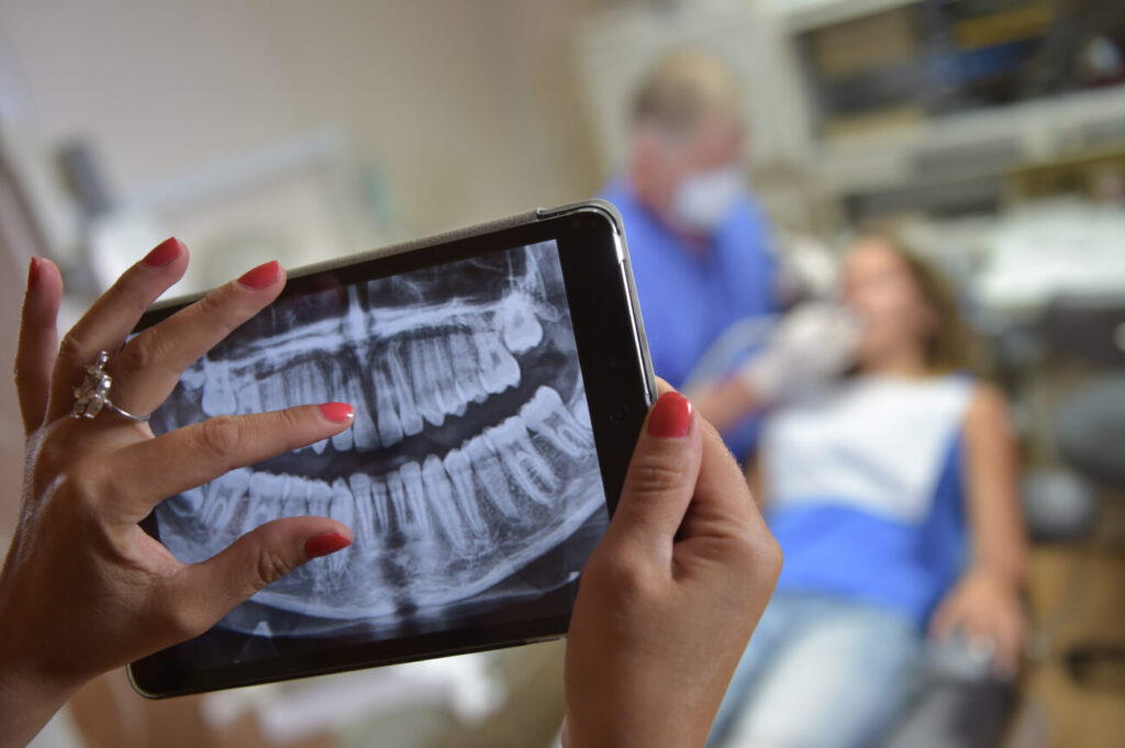 Tooth Extraction in Towson, MD