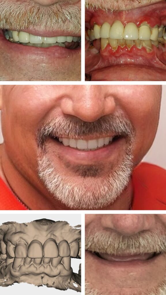 Dentures and Partials in Towson, MD
